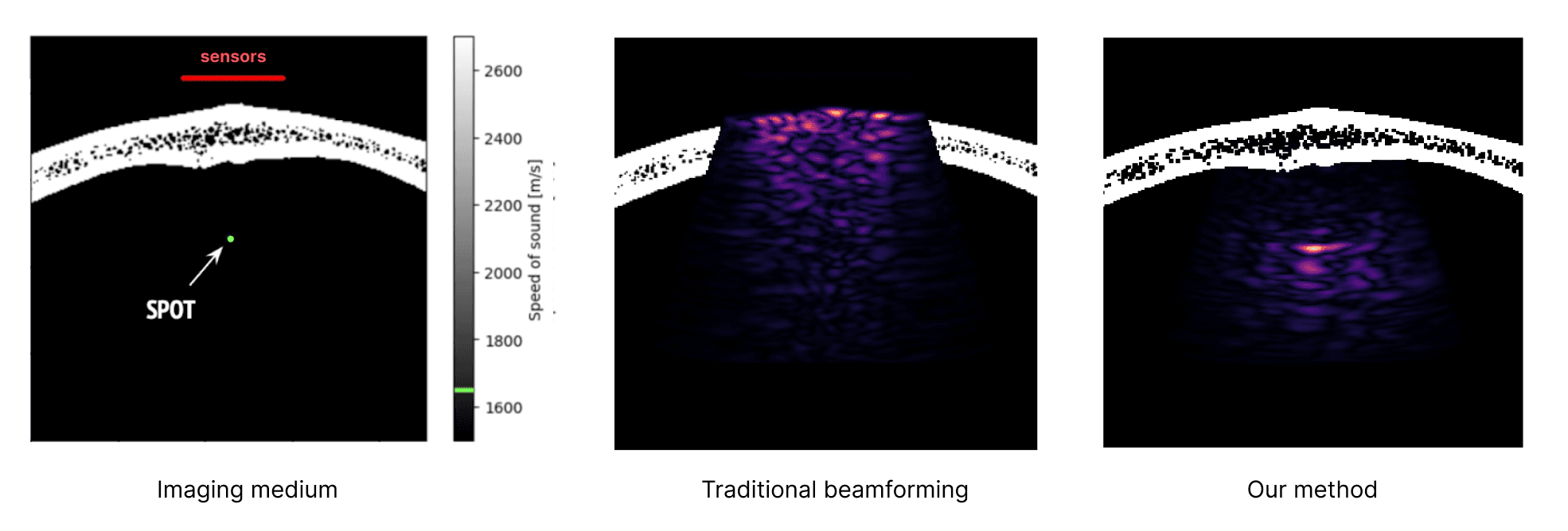 Comparison of regular beamforming and de-aberration algorithm results