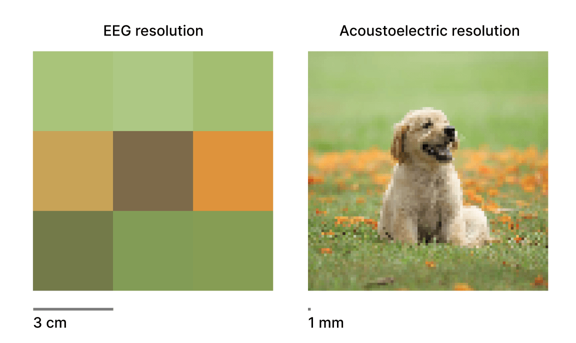 Comparison of resolution with regular EEG and with acoustoelectric imaging