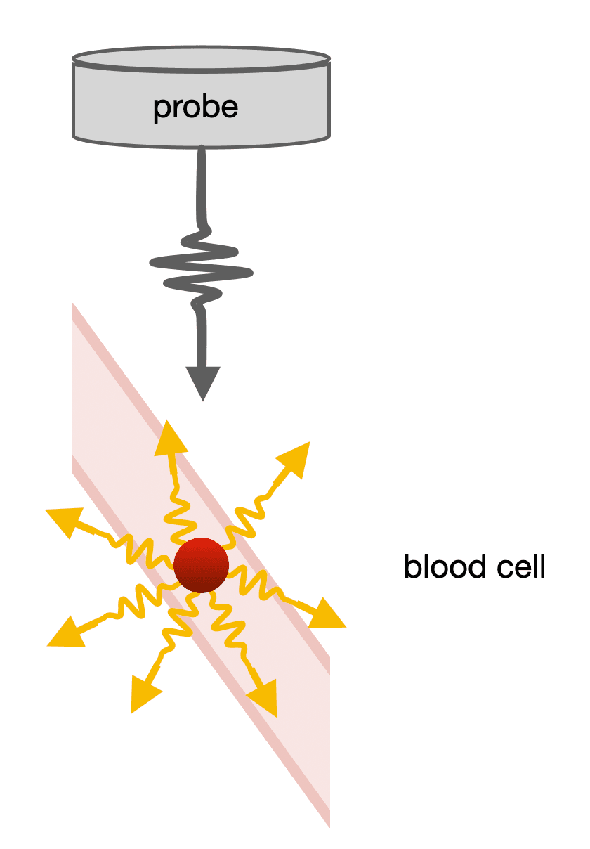 Diagram illustrating functional ultrasound imaging process